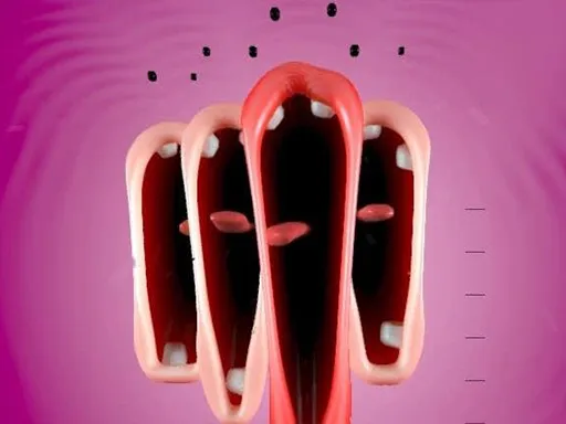 The Calculus of what is Lantern Weak to A Structural Breakdown of Damage Calcs and Usage